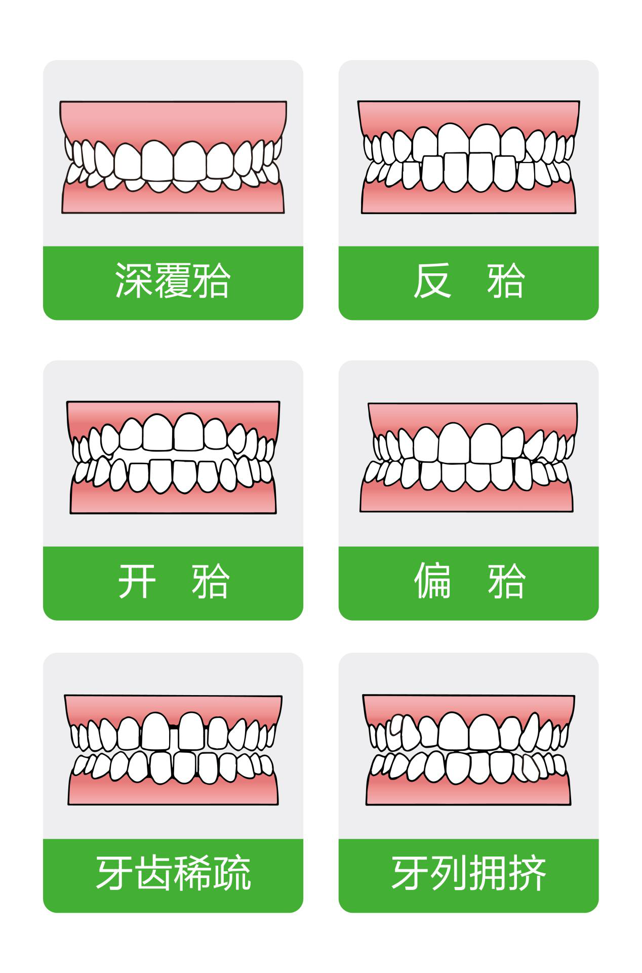 牙齿不齐还会影响咀嚼功能和身体健康,造成牙齿外伤及粘膜损伤等.