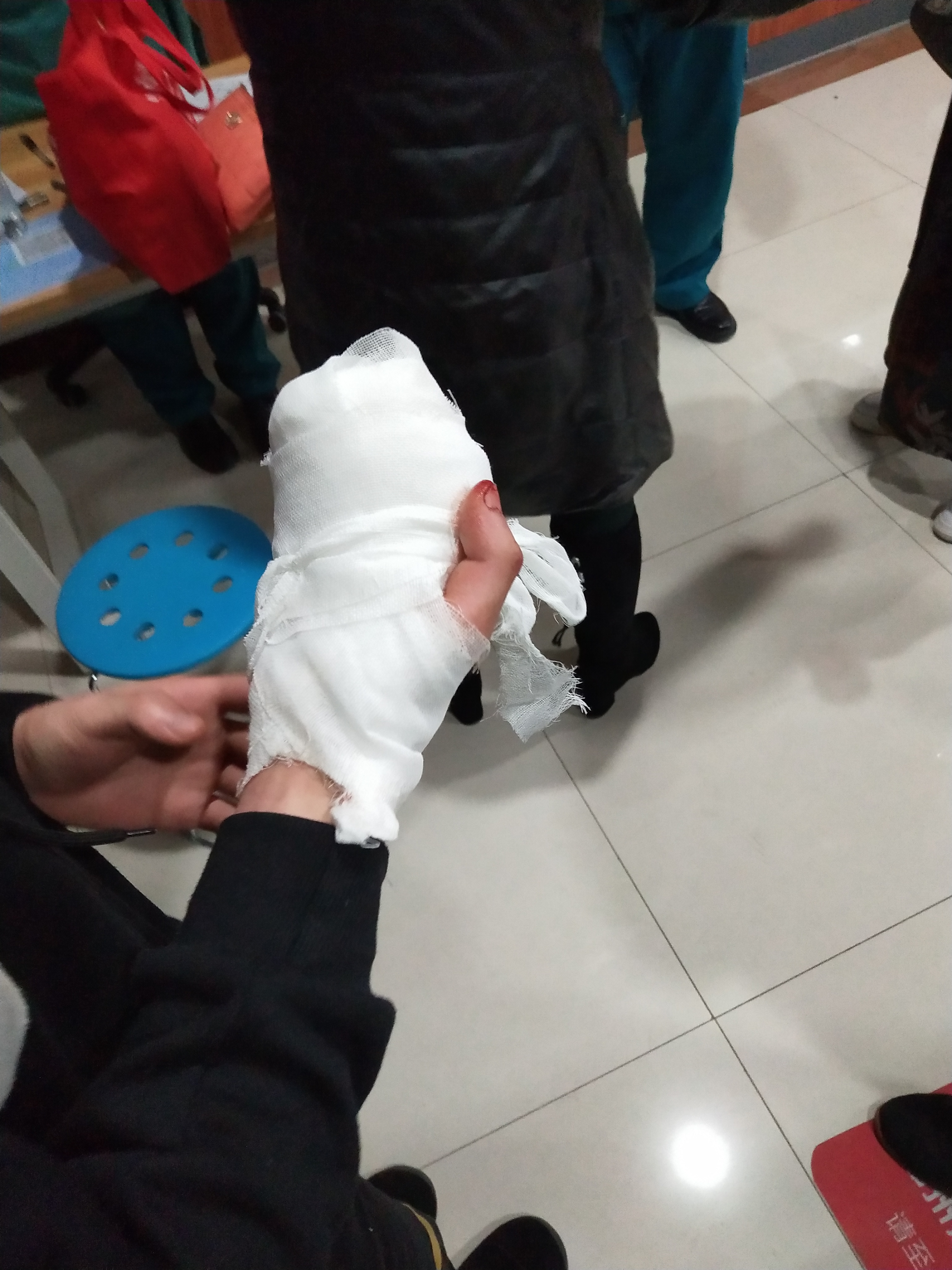 『郑州交通』许昌小伙右手被切断来郑就医，郑州交警驾车火速救援