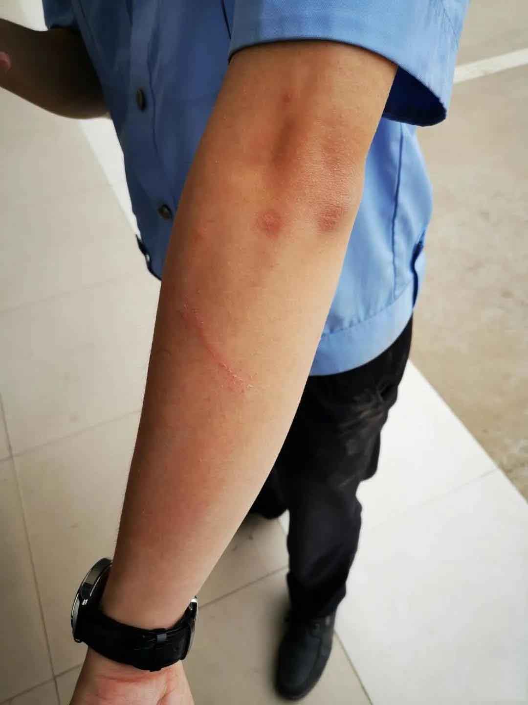 漯河对民警拳打脚踢，还将警车坐垫咬烂，漯河一女子被刑拘！