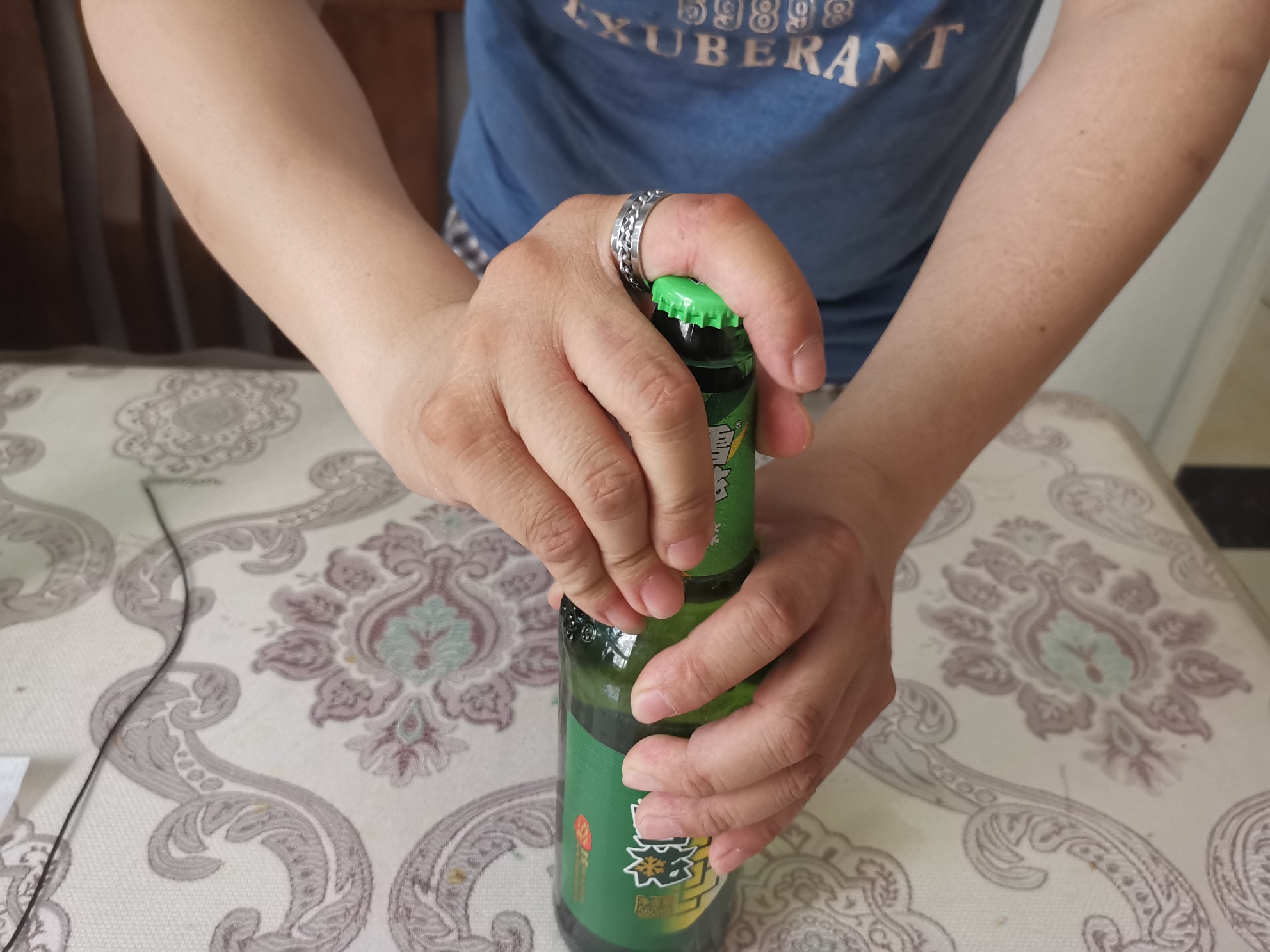 咬人能开酒瓶盖的网红戒指会“咬人”？记者试验后，手指出现……