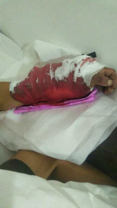 交通|抢救断臂，分秒必争！交警接力开道驰援