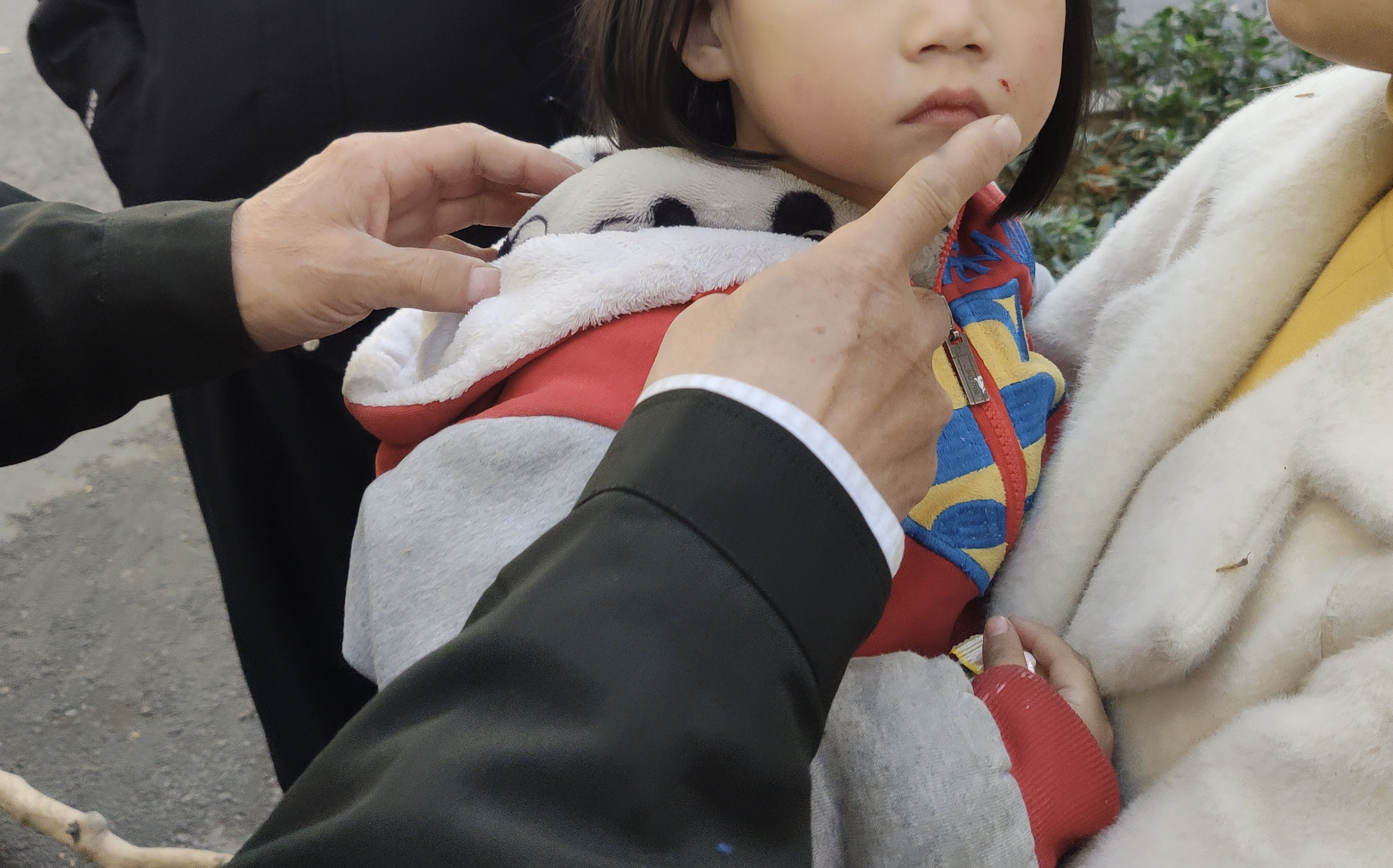 |枯枝从天而降，砸伤一对骑车母女