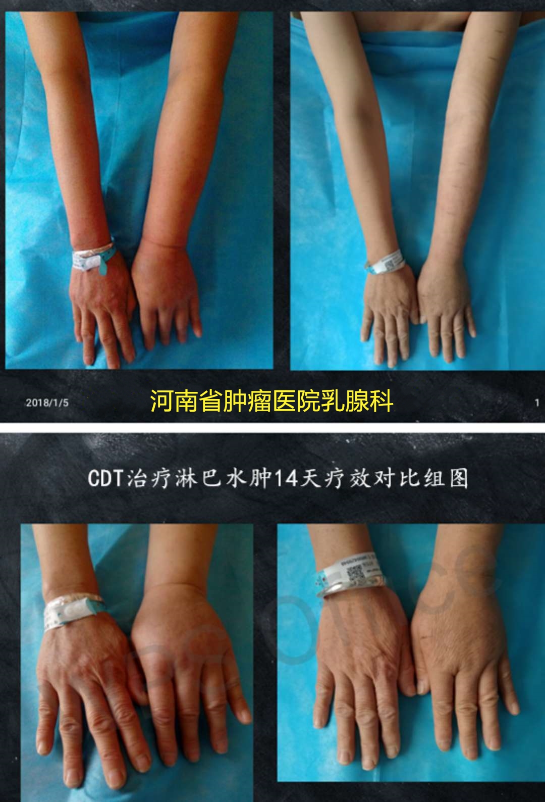 ΢ͼƬ_20180312165905_