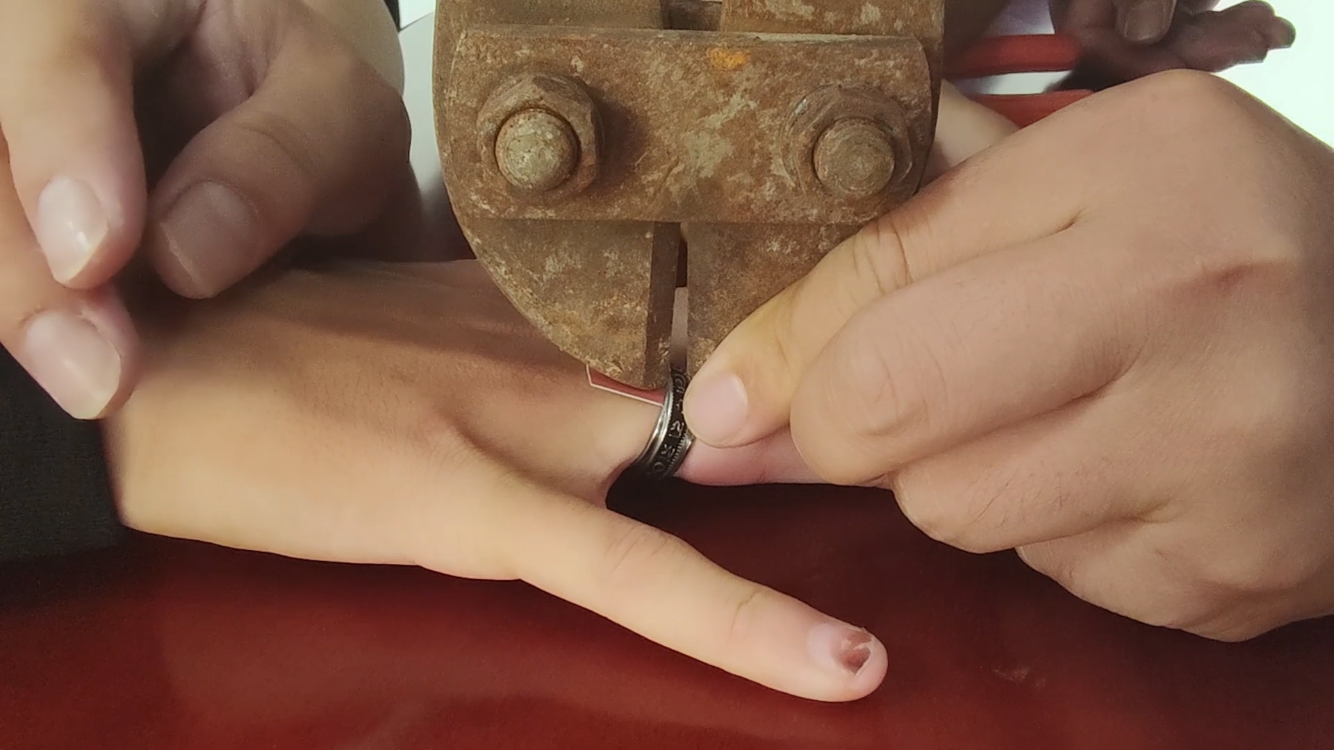 |戒指“咬住”男孩手指不松嘴 消防员拿起大钳子细心做手术