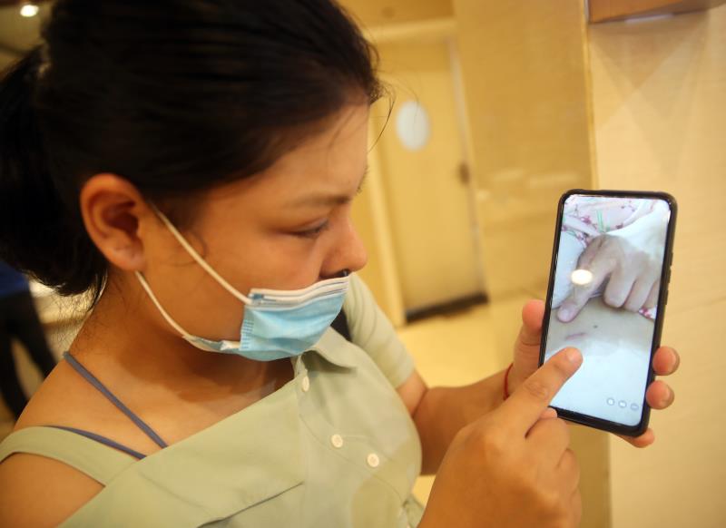 医疗|女子鼻部整形术后鼻孔一大一小？美容医院：鼻孔轻度不对称属正常反应