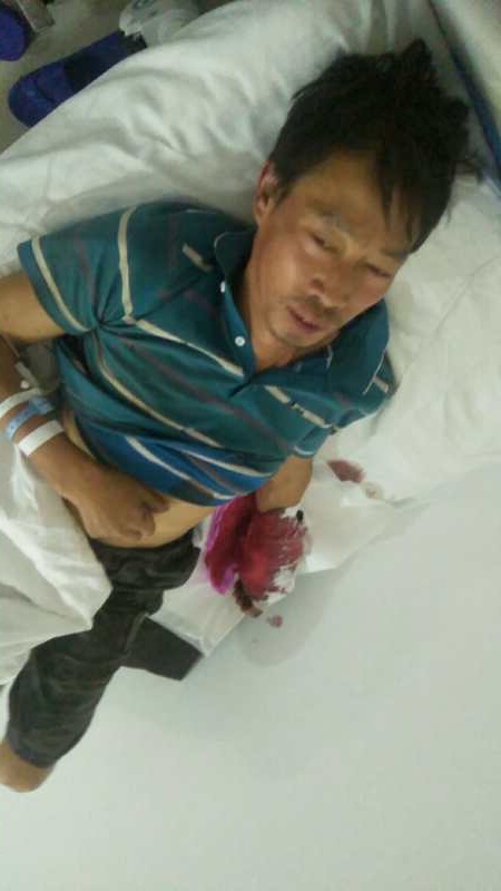 交通|抢救断臂，分秒必争！交警接力开道驰援