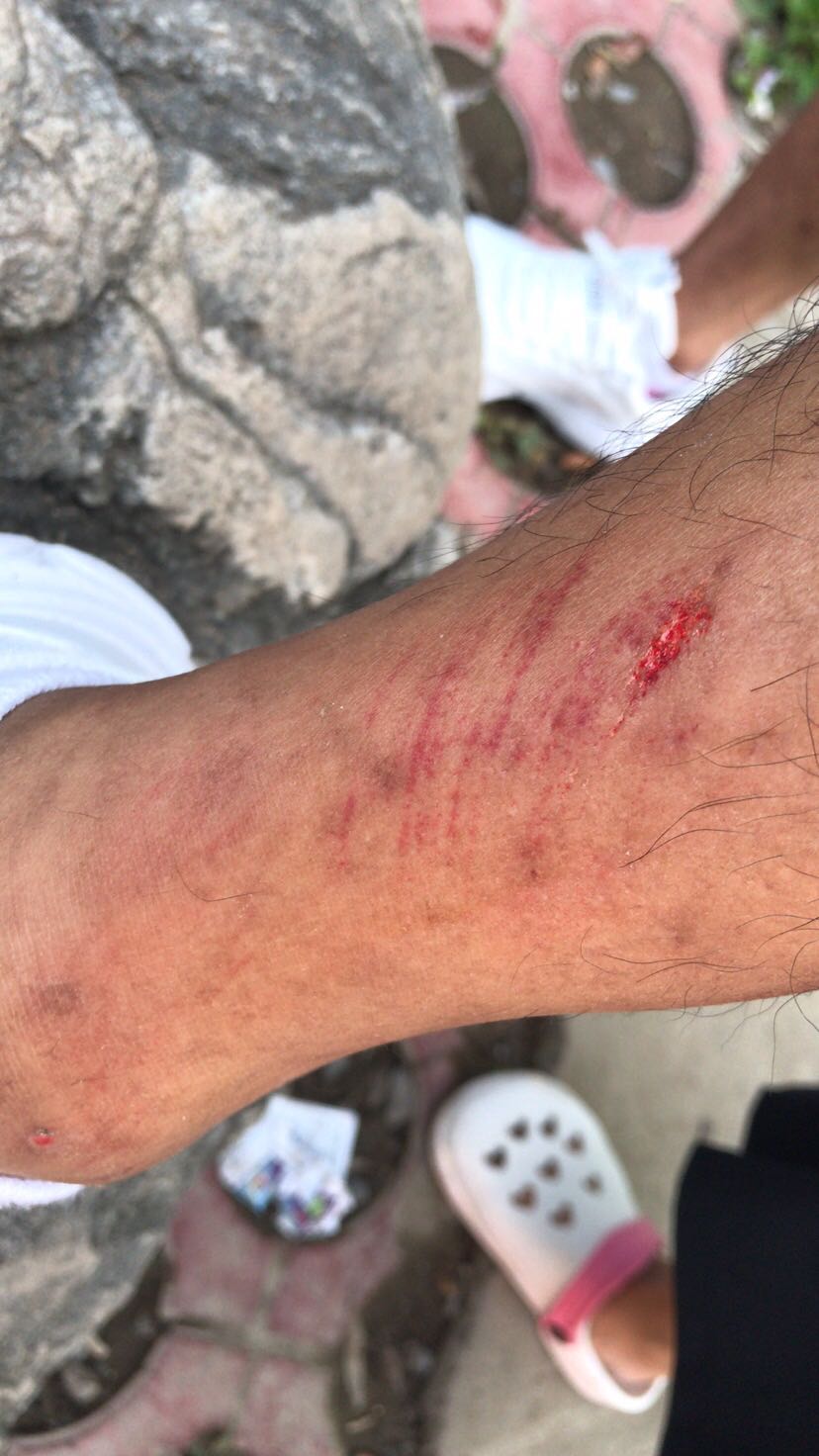 众多游客王屋山漂流受伤长时间无人管 景区称游客不配合额外要求赔偿