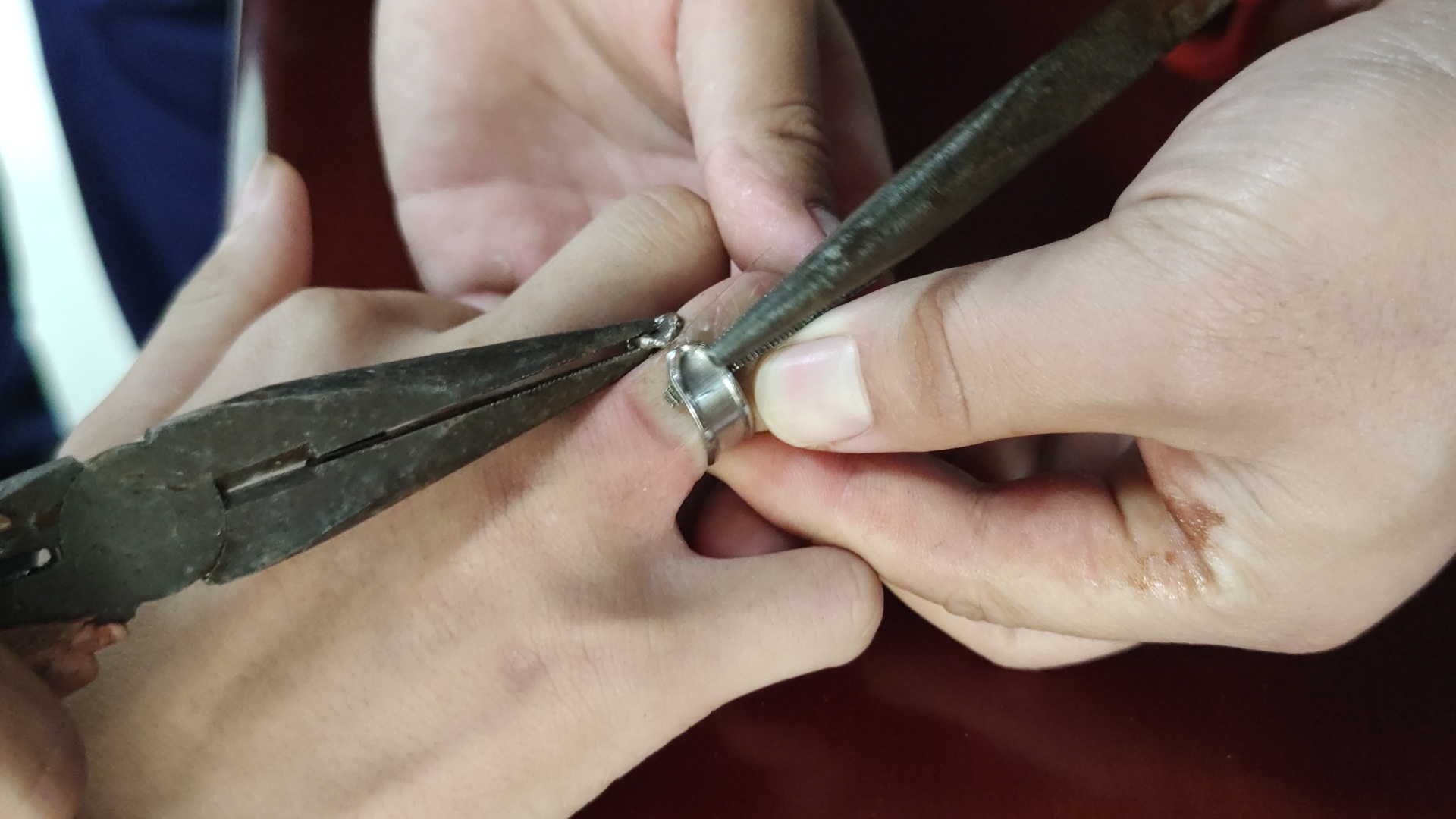 |戒指“咬住”男孩手指不松嘴 消防员拿起大钳子细心做手术