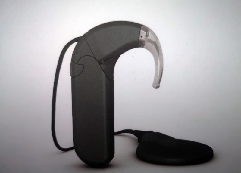 人工耳蜗|哭诉：郑州4岁女童先天性耳聋 20万元人工耳蜗丢失