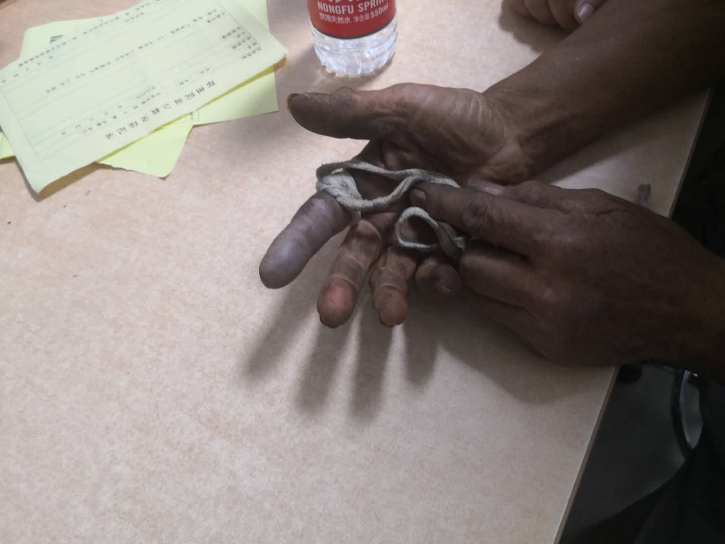 交通|河南一老汉被毒蛇咬伤，高速交警深夜护送