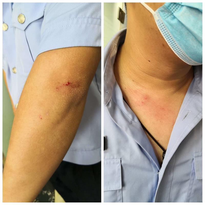 被执行|因房屋租赁纠纷成被执行人，到了法院却“撒泼”抓伤法警