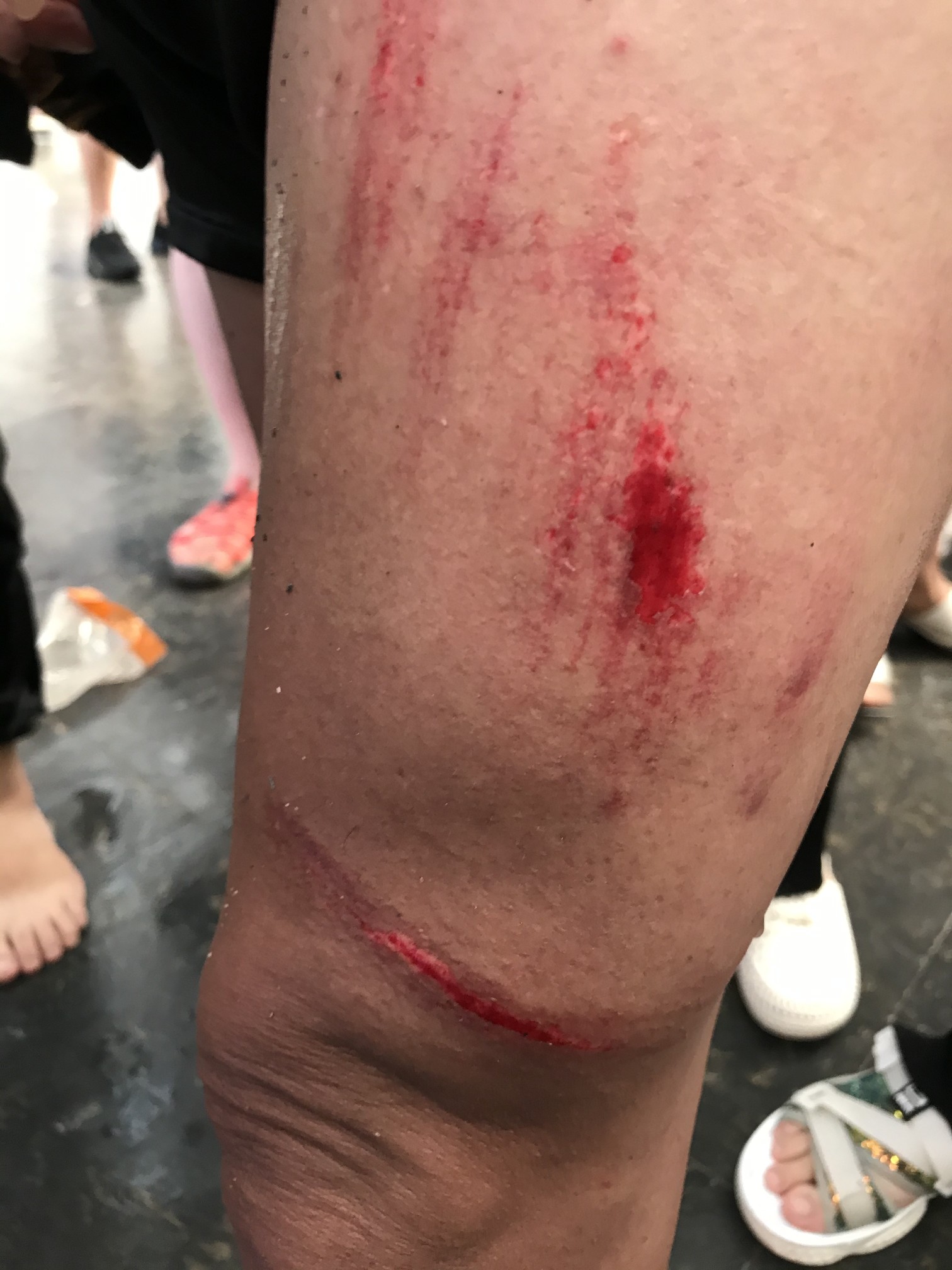 众多游客王屋山漂流受伤长时间无人管 景区称游客不配合额外要求赔偿