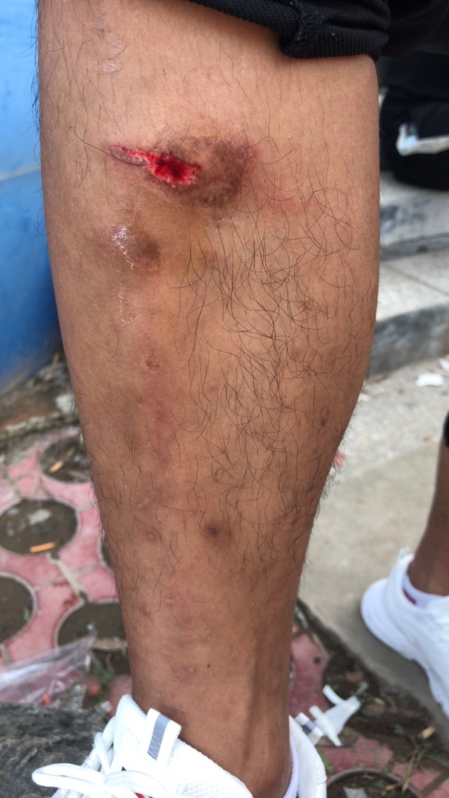 众多游客王屋山漂流受伤长时间无人管 景区称游客不配合额外要求赔偿