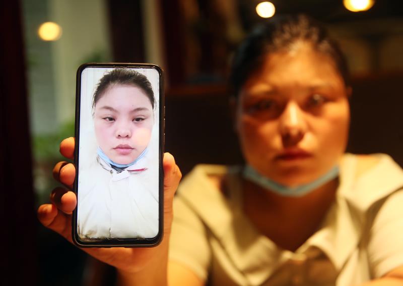 医疗|女子鼻部整形术后鼻孔一大一小？美容医院：鼻孔轻度不对称属正常反应