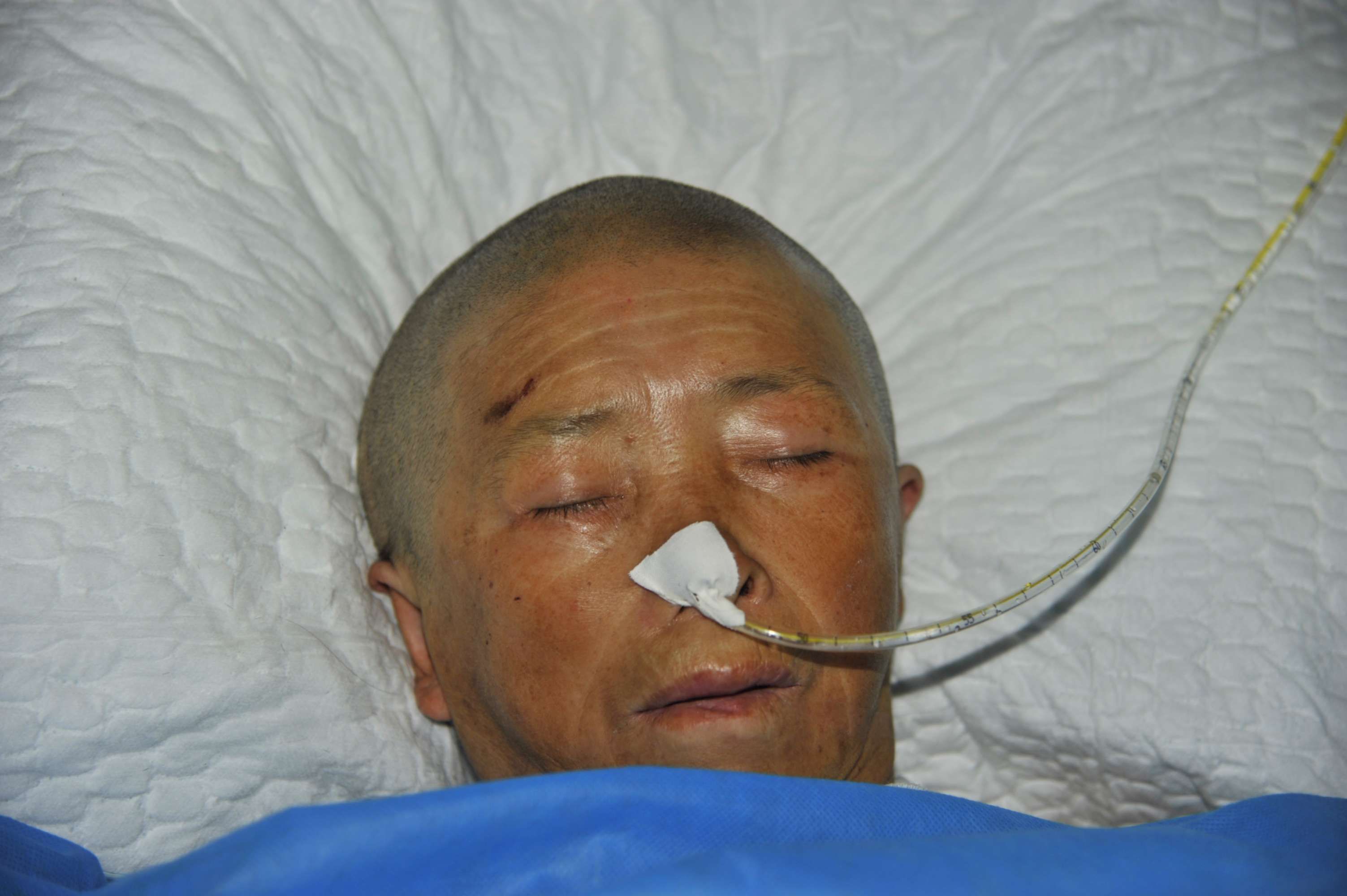 扩散信阳这家医院的深度昏迷患者急寻家人