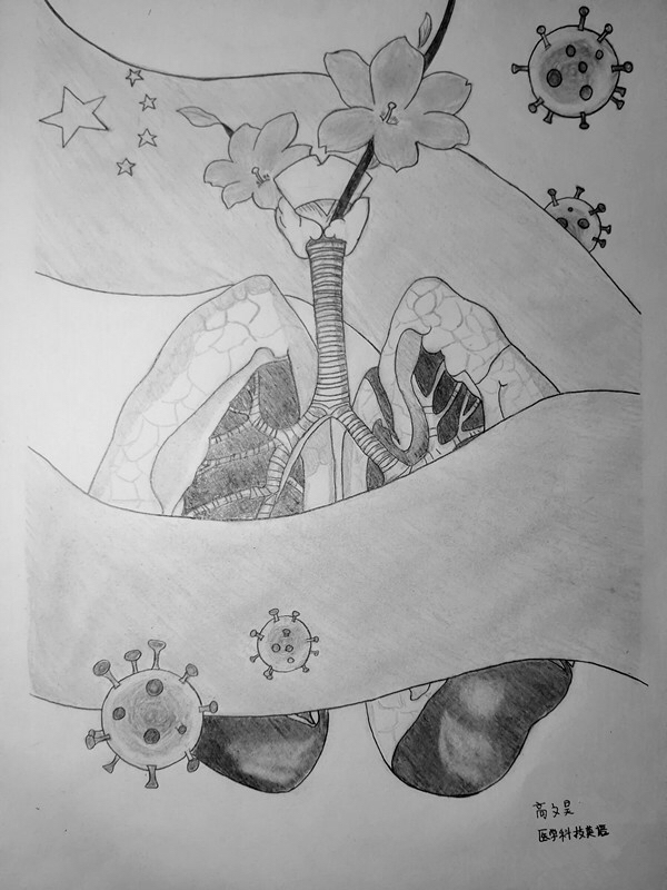 肺脓肿手绘图图片