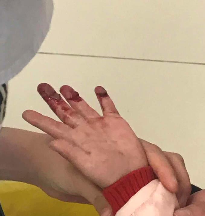 女童左手受伤鲜血直流漯河辅警晚高峰仅用5分钟护送至医院